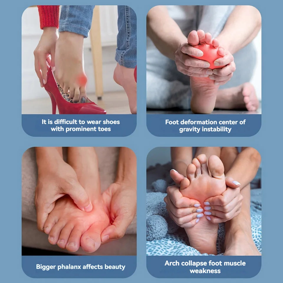 Adjustable Hallux Valgus Bunion Corrector