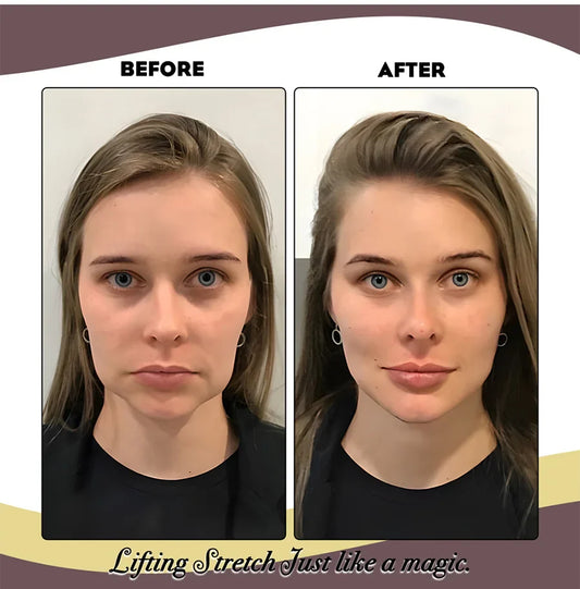 Elastic Face Lifting Band