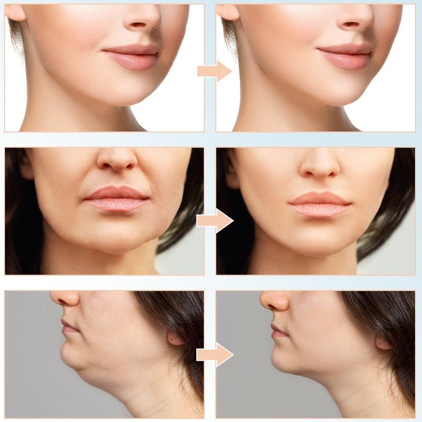 AgelessAura EMS Face Lifting Machine