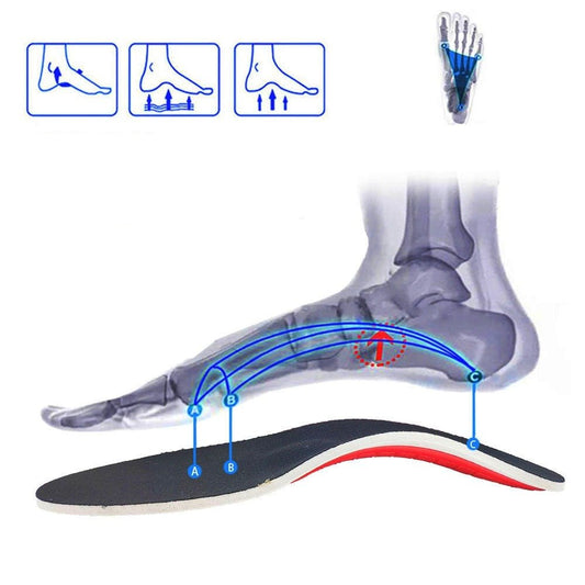 ArchEase Orthotic Insoles