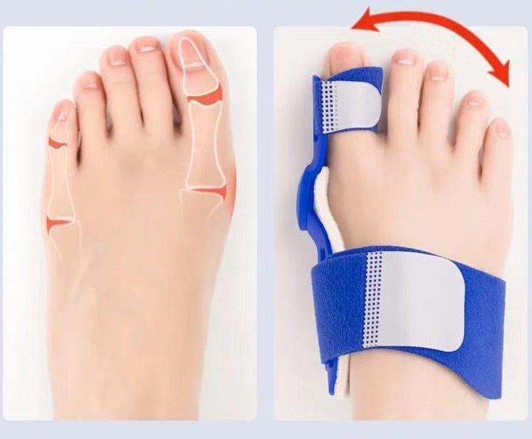 Big Toe Corrector