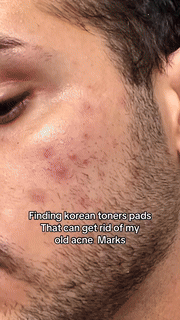 Skin Care Zero Pore Toner Pad