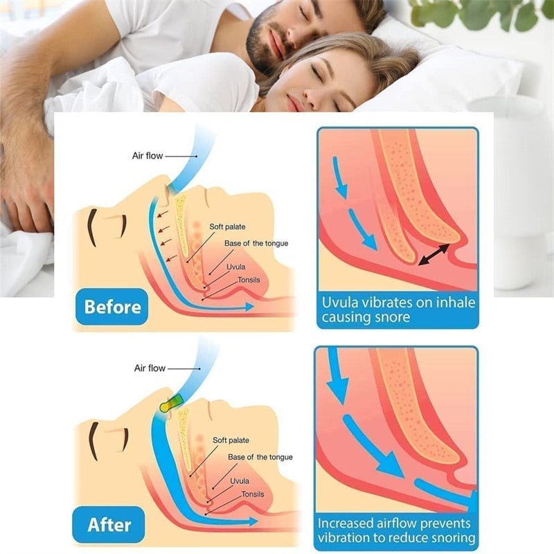 SilentSlumber SnoreClip