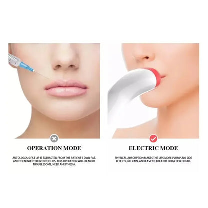 Electric Lip Enhancer Device