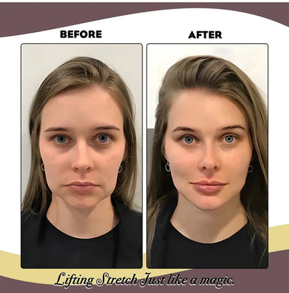 Elastic Face Lifting Band
