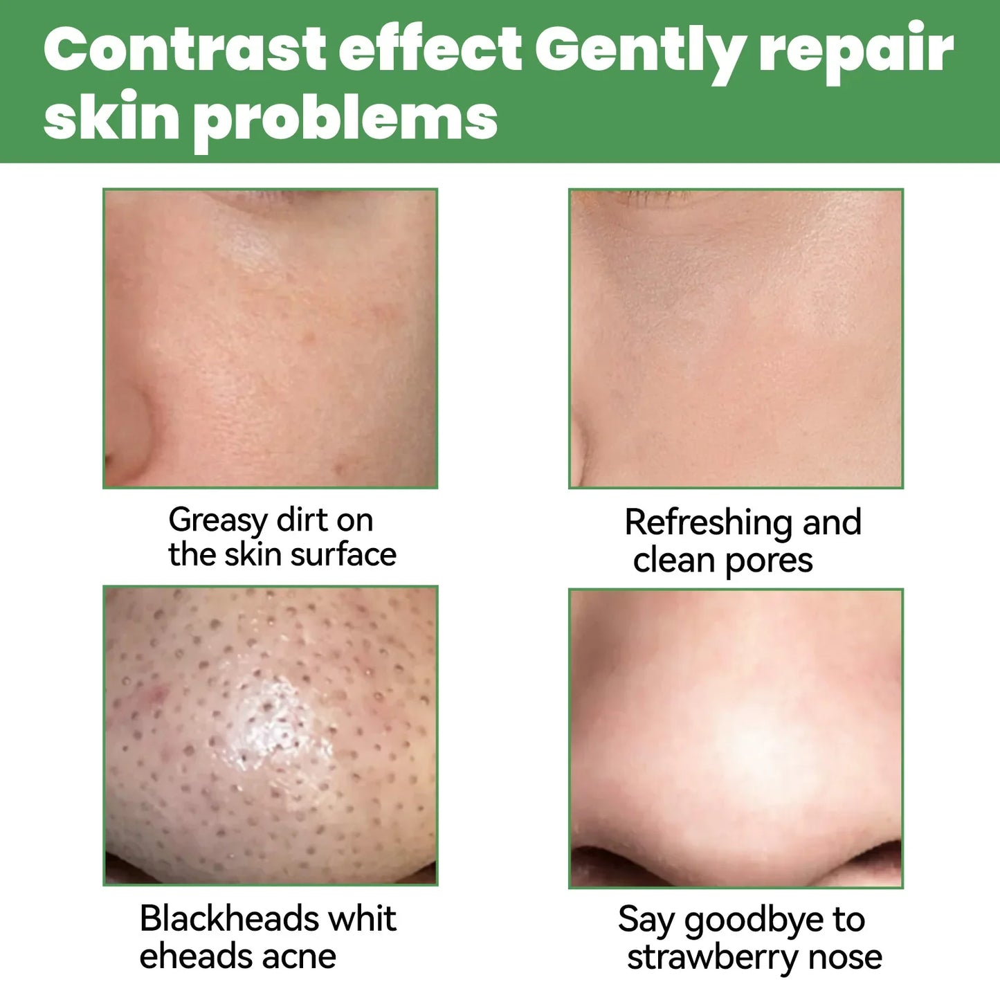 Moisturizing Carbonated Bubble Blackheads Removal