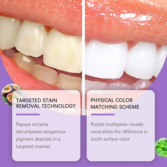 Purple Teeth Whitening Luxe Toothpaste