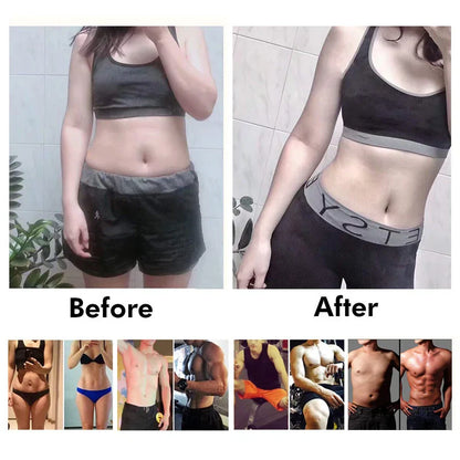 EMS Muscle Toning Device