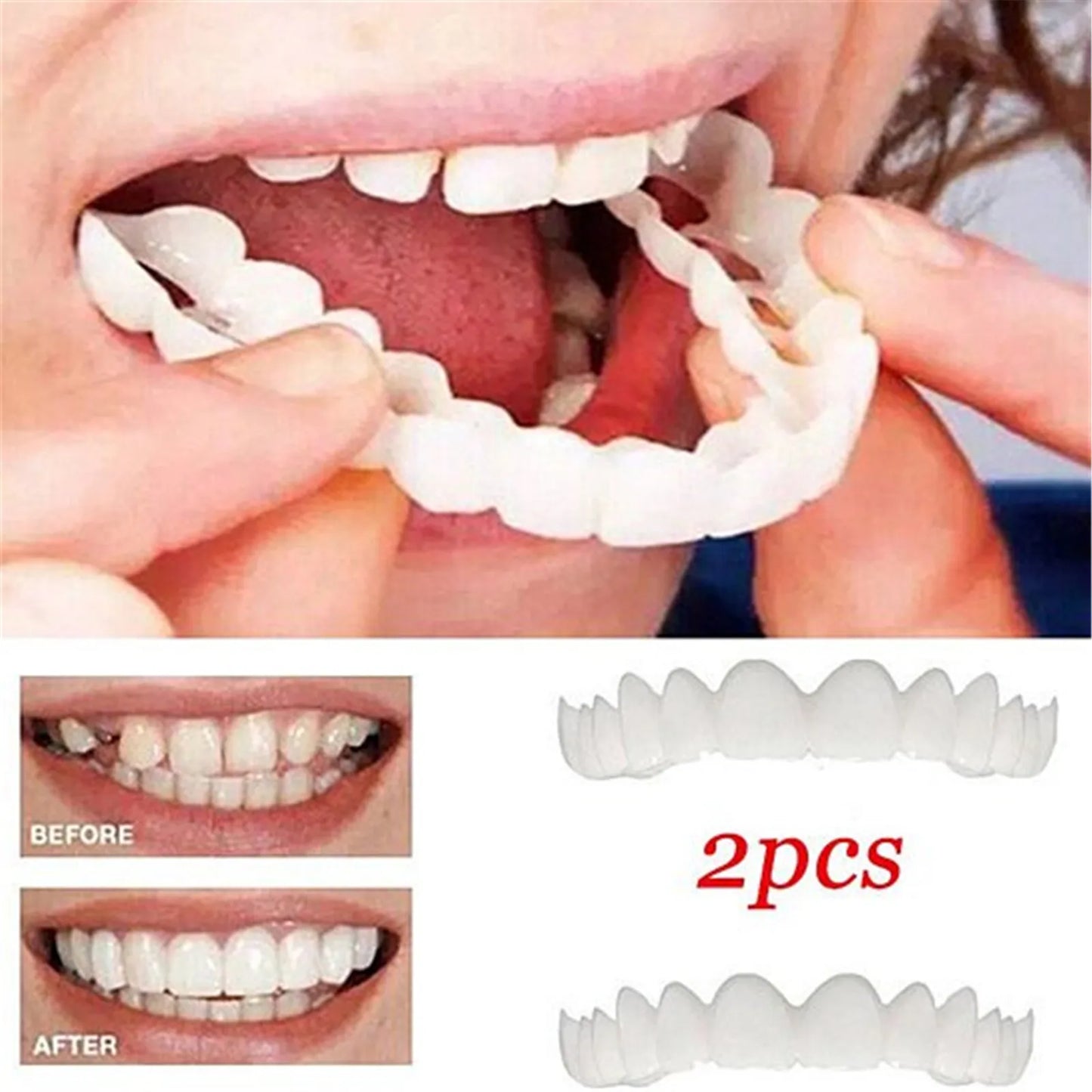 Comfort Fit Temporary Teeth Cover