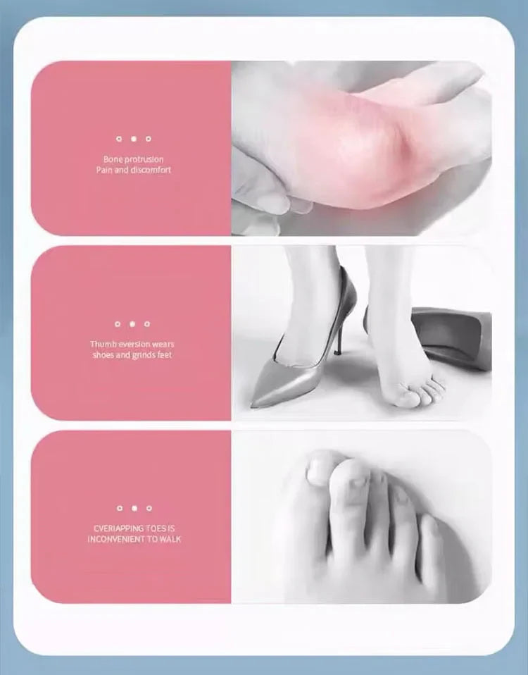 Silicone Hallux Valgus Bunion Corrector