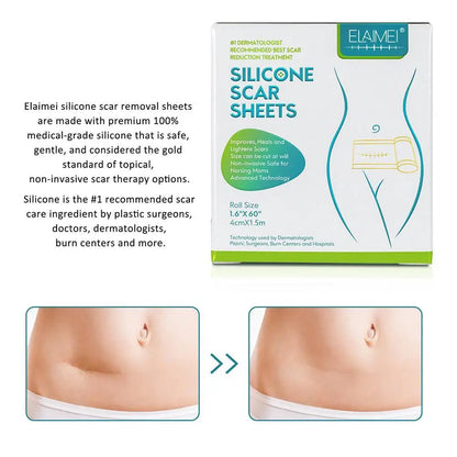 Silicone Gel Scar Repair Patch