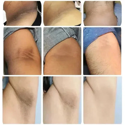 Dark Spot Removal Serum