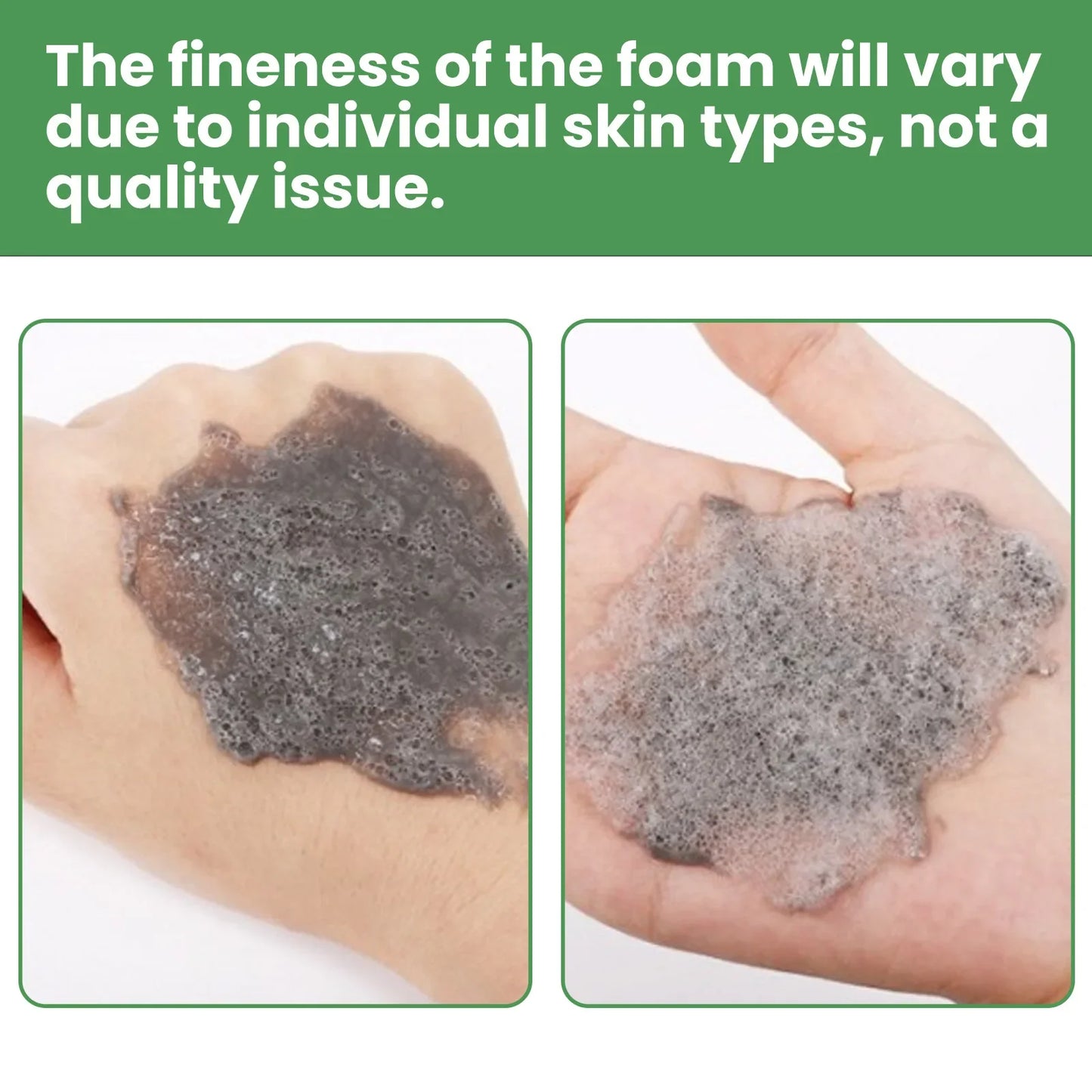 Moisturizing Carbonated Bubble Blackheads Removal